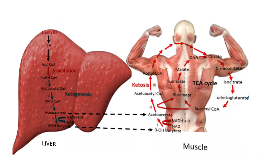 Ketoacidosis