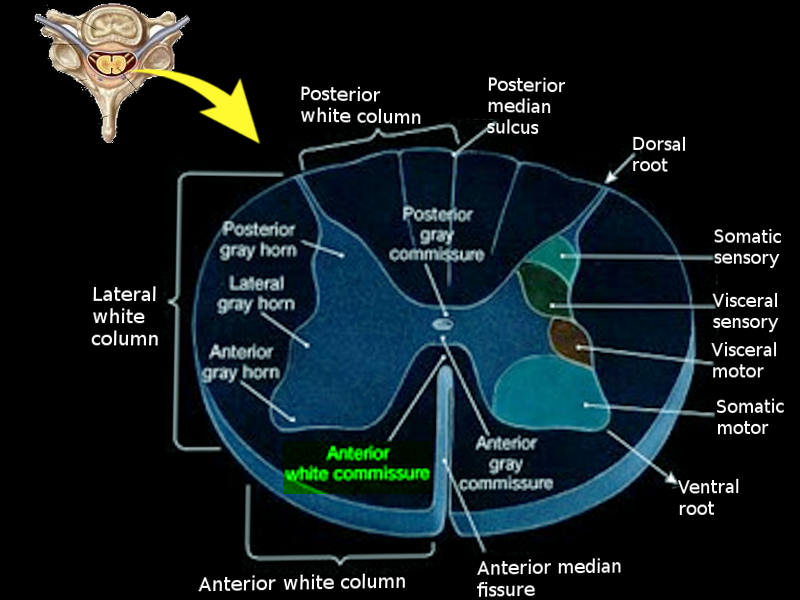 Anterior white commissure