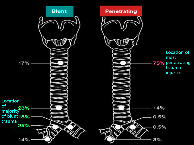 Locations of tracheal injury