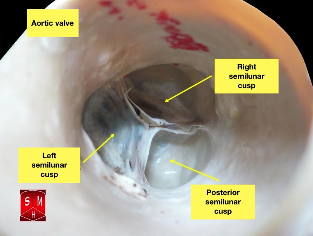 Aortic Valve