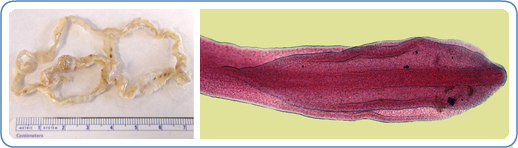 Diphyllobothrium latum