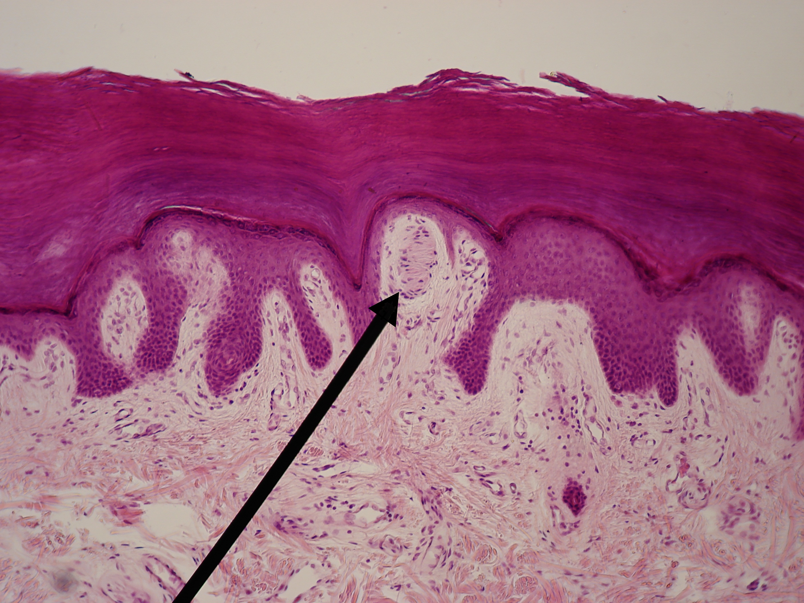 100x light micrograph of Meissner's corpuscle (or tactile corpuscle) at the tip of a dermal papillus