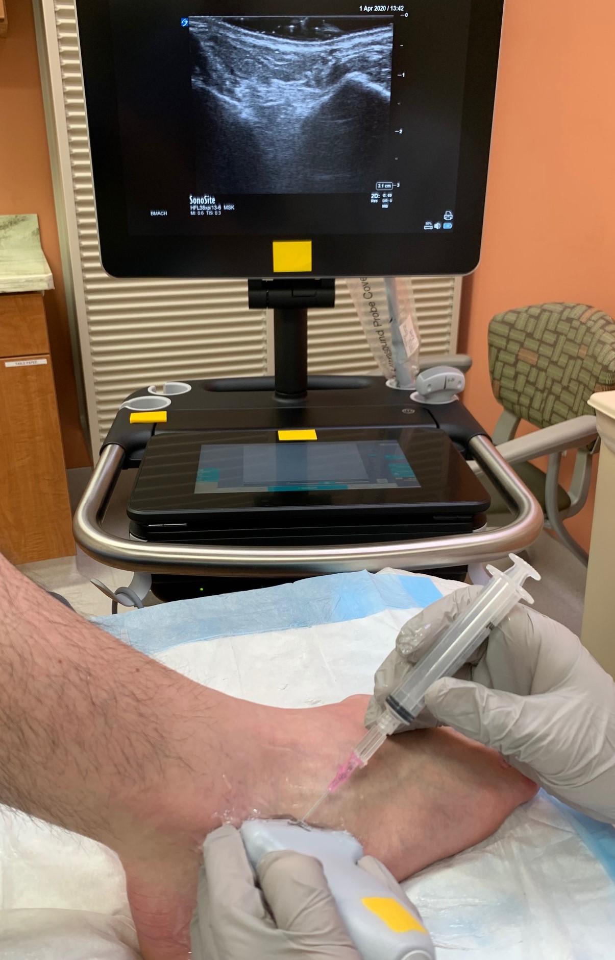 Demonstration of positioning and location for access to subtalar ankle joint with ultrasound guidance