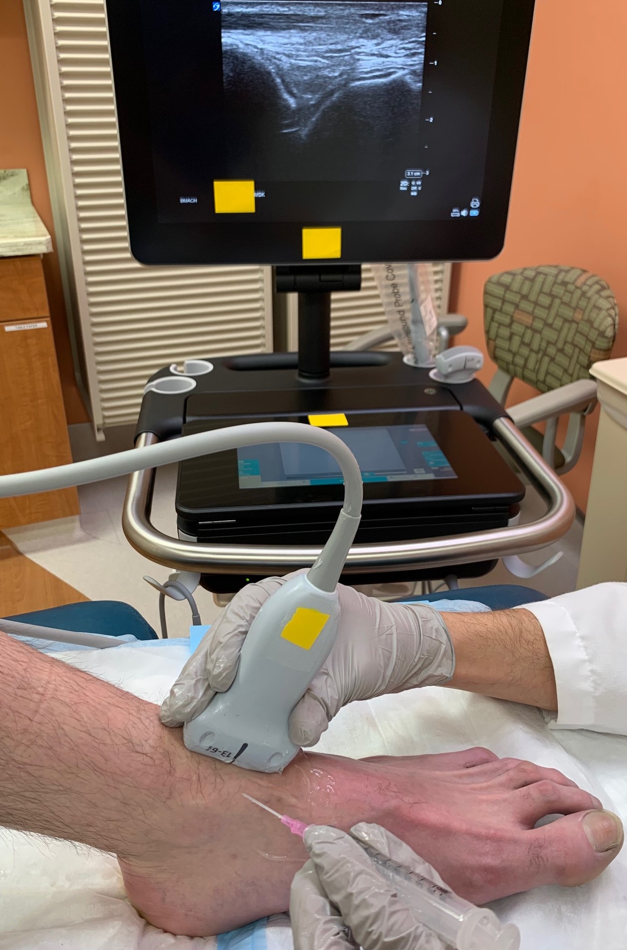 Demonstration of positioning and location for access to tibiotalar ankle joint with ultrasound guidance