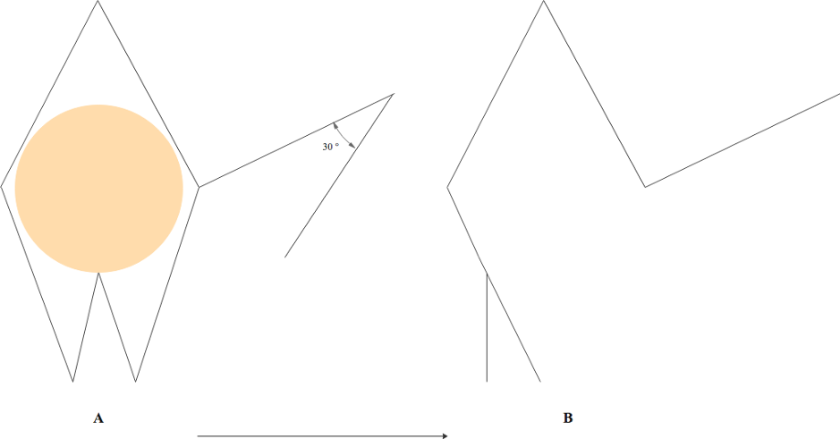 Figure 3: Webster Rhombic Flap Modification