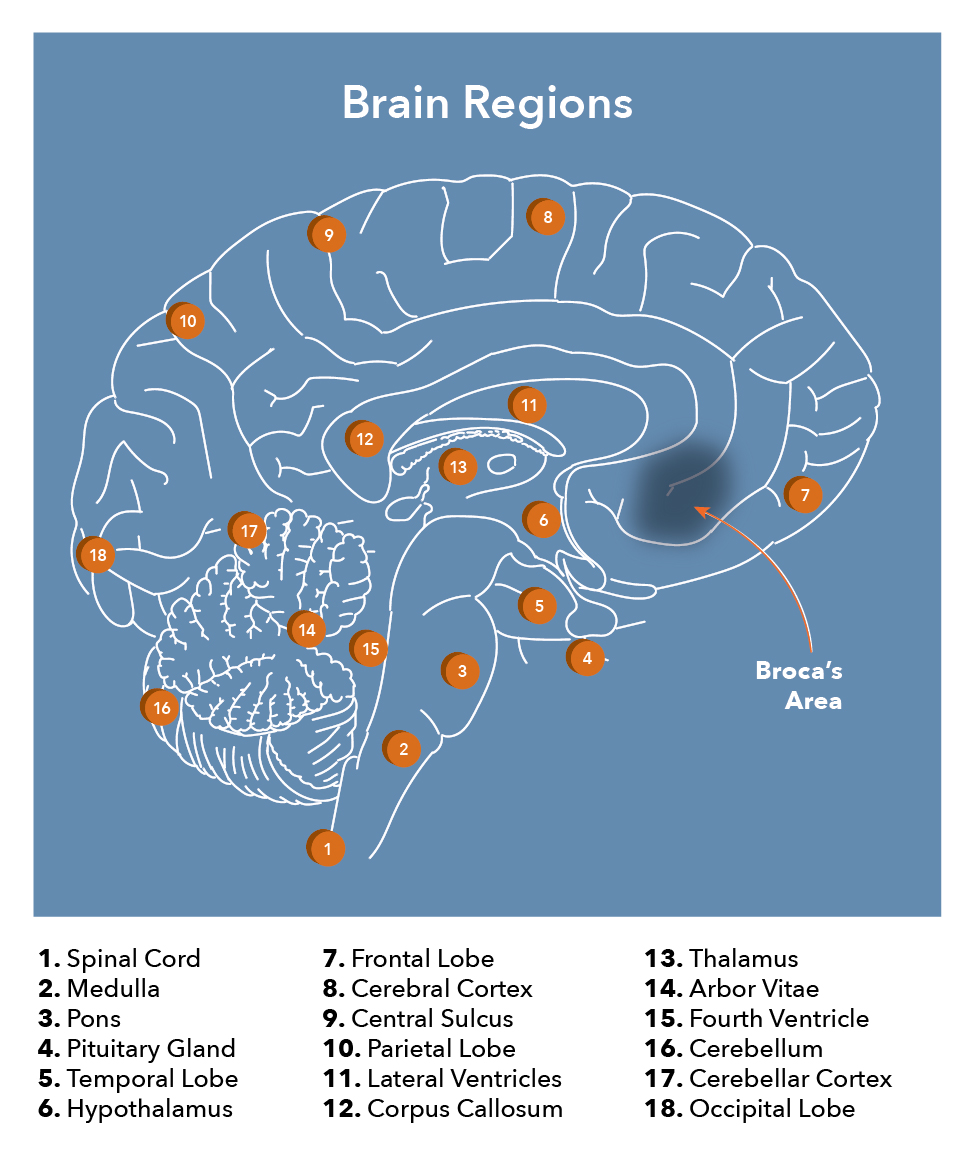 Broca's area