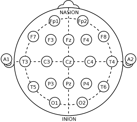 International 10-20 system for placement of surface electrodes