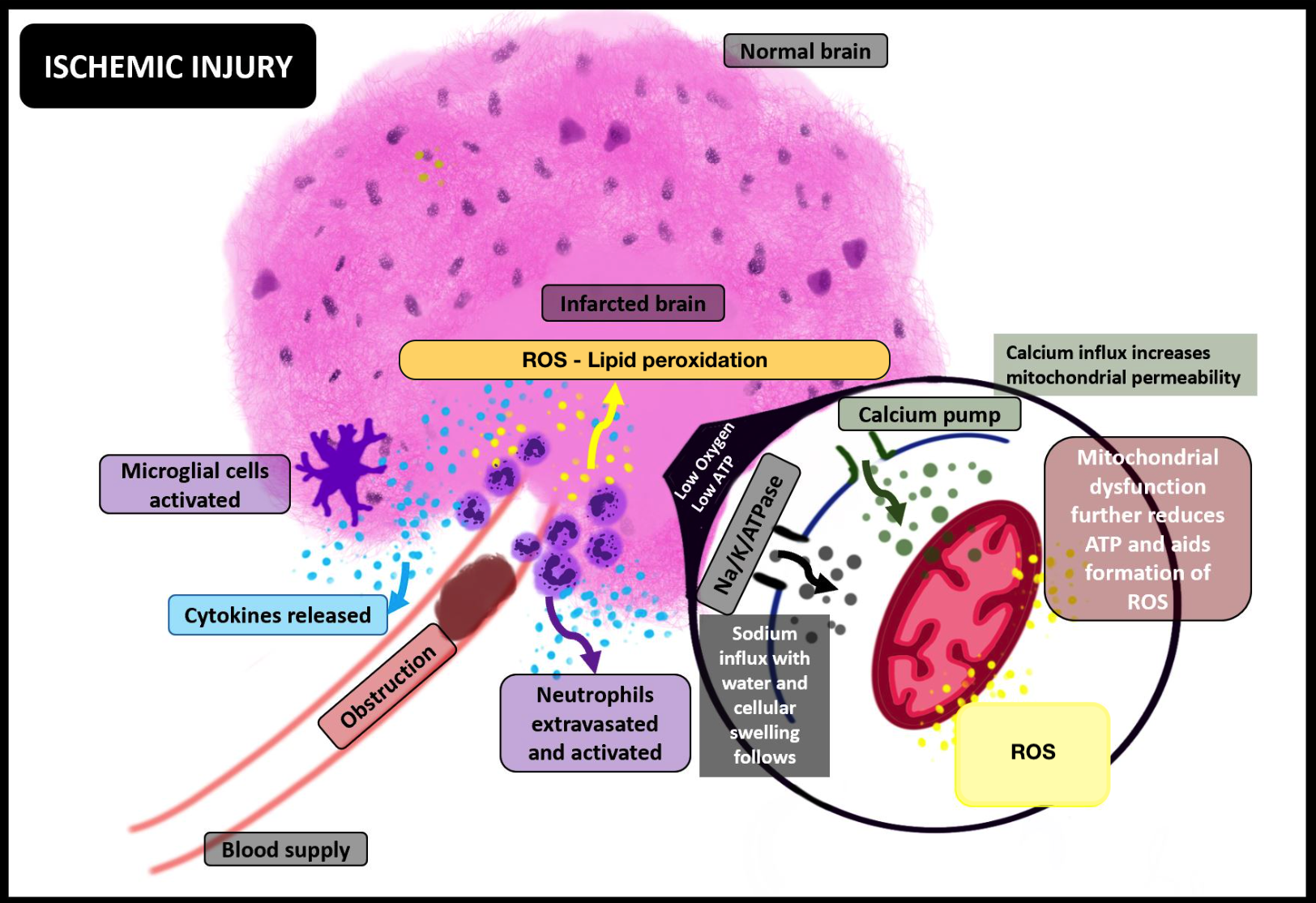 Ischemic Injury and its molecular consequences