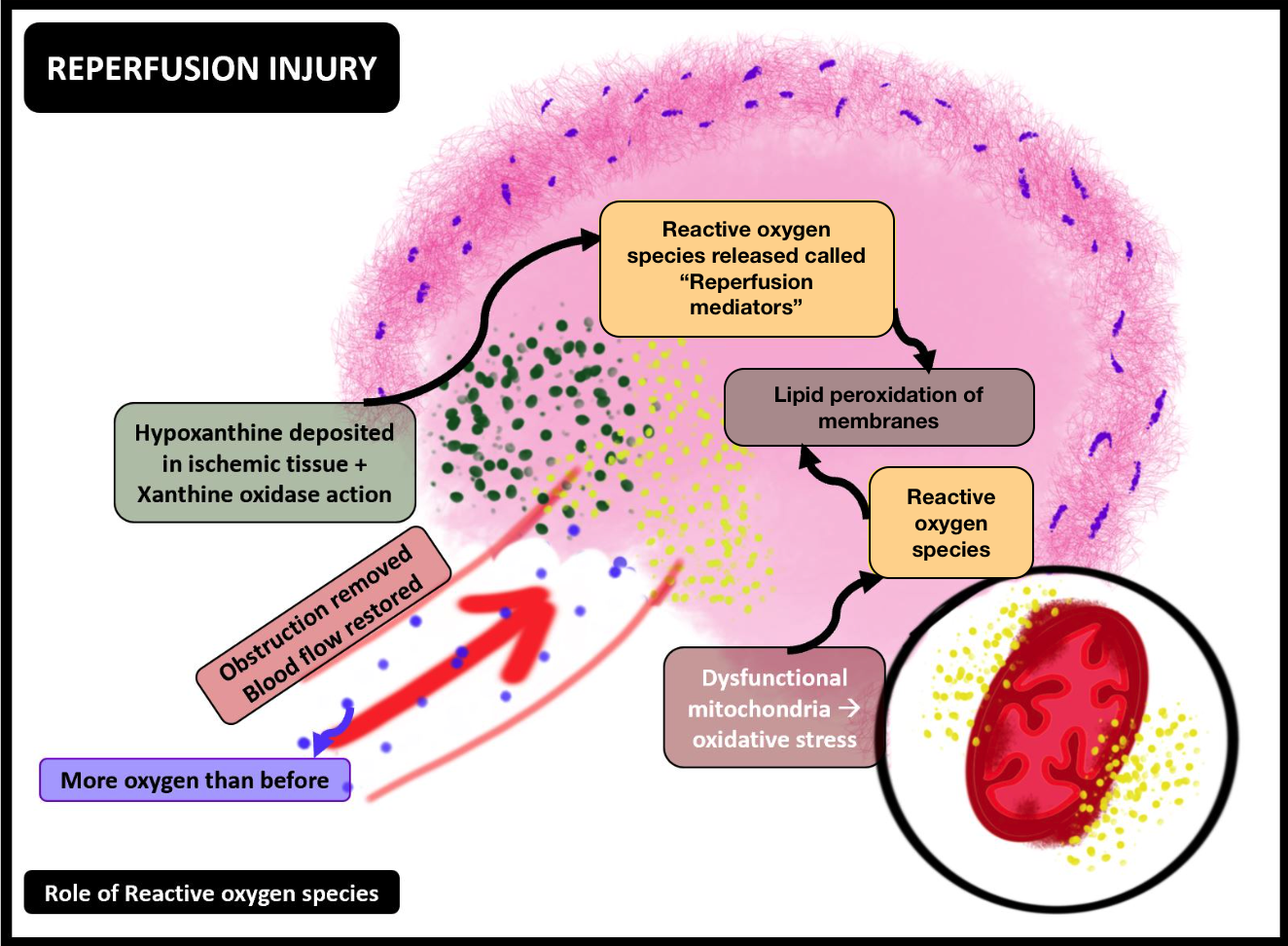 Ischemia-Reperfusion injury:role of the reactive oxygen species