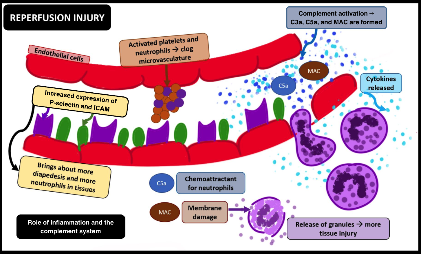 Ischemia-Reperfusion injury: role of inflammation and complement system