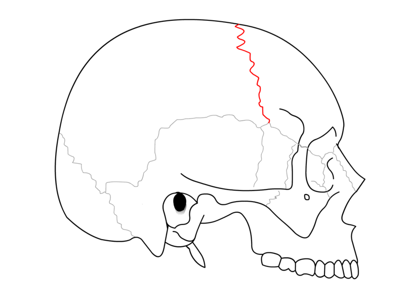 Coronal Suture