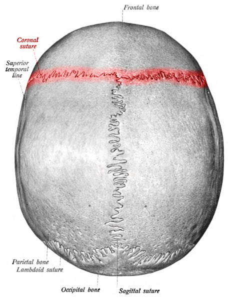 Coronal Suture lined as Red