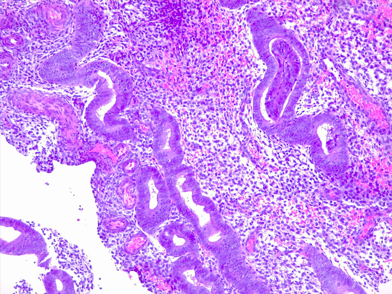 Endometrial biopsy, proliferative endometrium. 10x H/E.