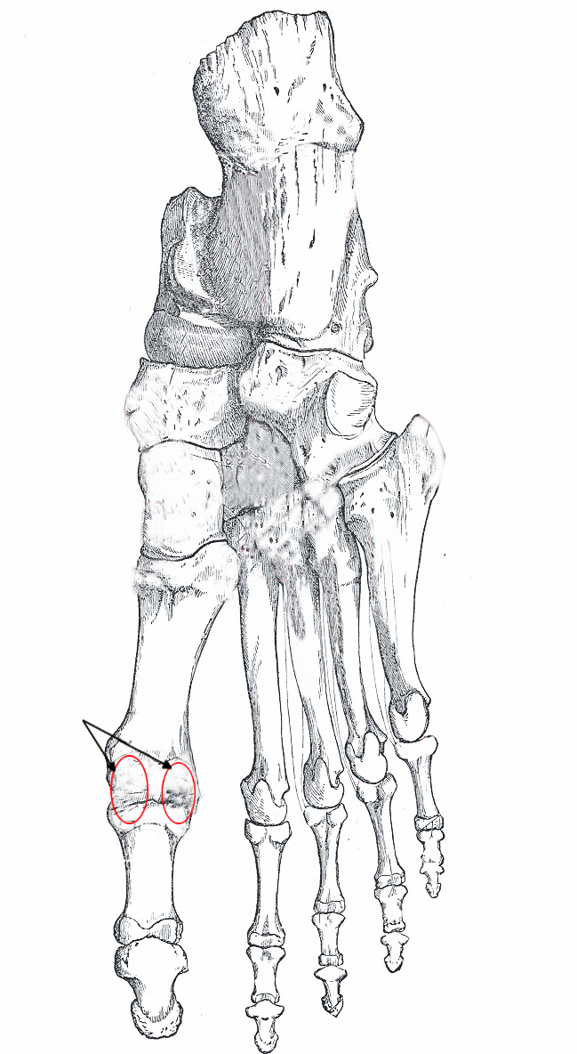 Right, Foot, Bones, Plantar Surface, Calcaneus, Abductor Hallucis, Quadratus Plantar, Abductor Digiti Quinti, Talus, Navicula