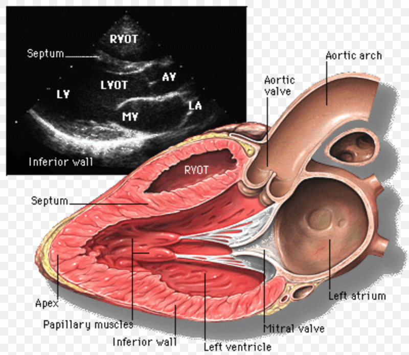 Parasternal Long Axis