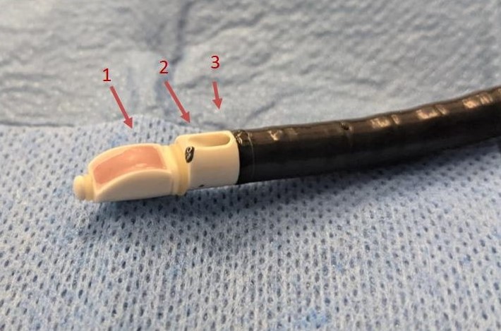 Convex endobronchial ultrasound scope labelled to demonstrate the side viewing ultrasound transducer (1), the forward facing fibreoptic bronchoscope (2), and the working channel (3)