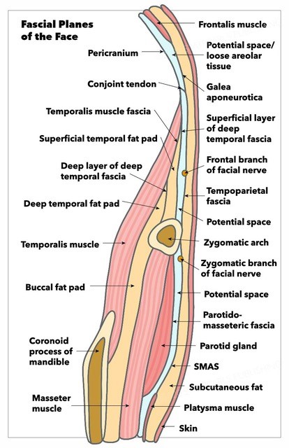 Fascial planes of the face, demonstrating continuity of frontalis muscle, galea aponeurotica, temporoparietal fascia, SMAS, and platysma, as well as location of facial nerve