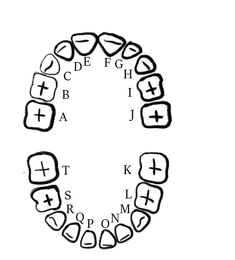 Primary dentition of a pediatric patient:
A: Right maxillary 2nd molar;
B: Right maxillary 1st molar;
C: Right maxillary c