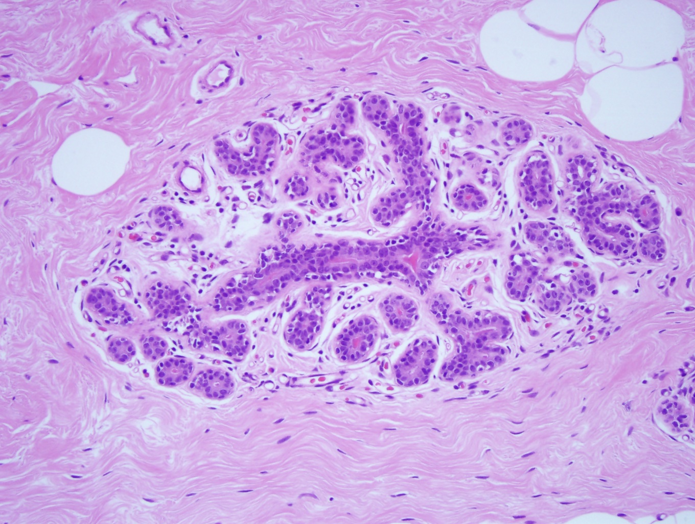 Microscopic anatomy of normal female breast tissue showing a terminal duct lobular unit (TDLU) 