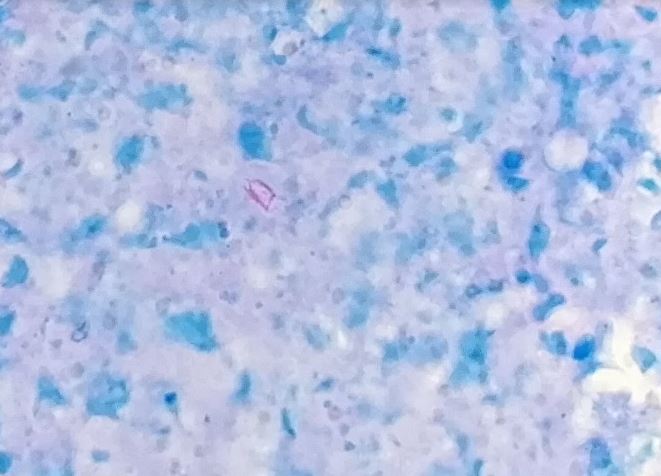 <p>Acid-Fast Bacilli</p>