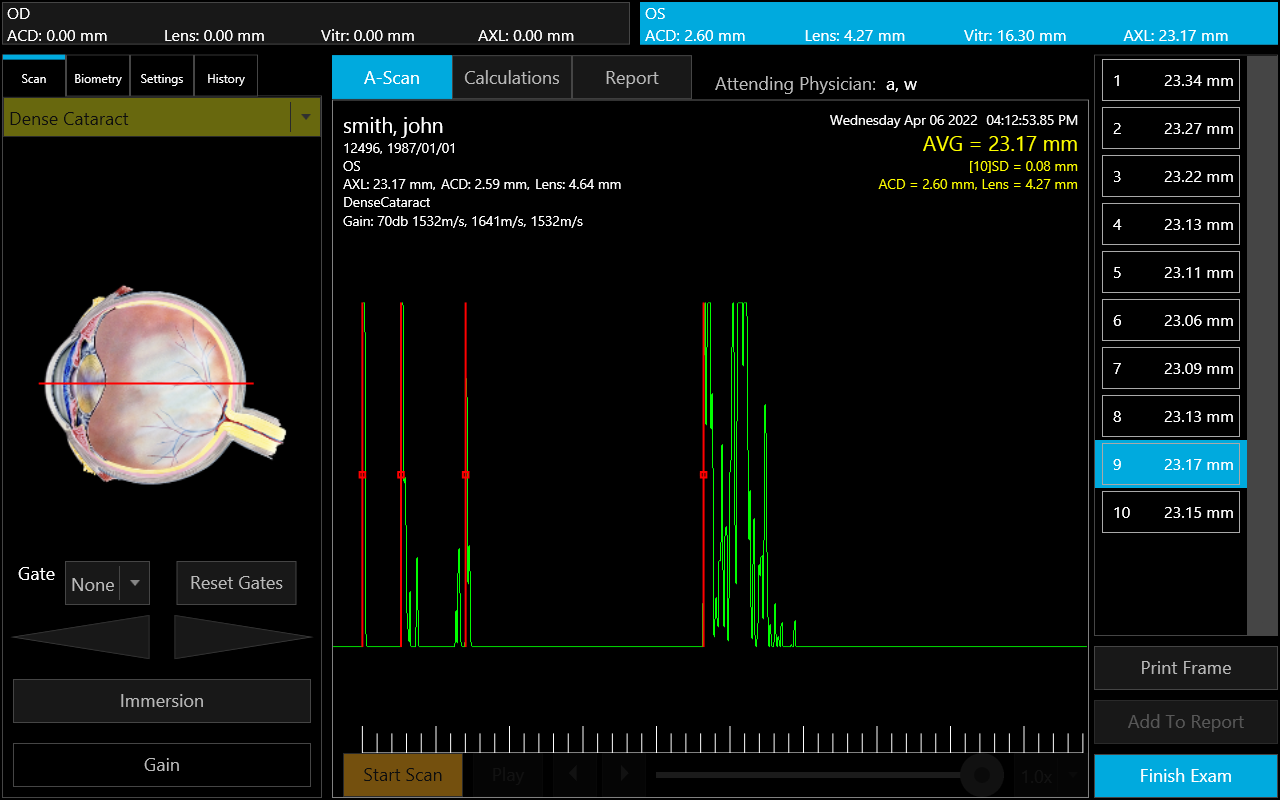 Figure 1: An example of ultrasound biometry