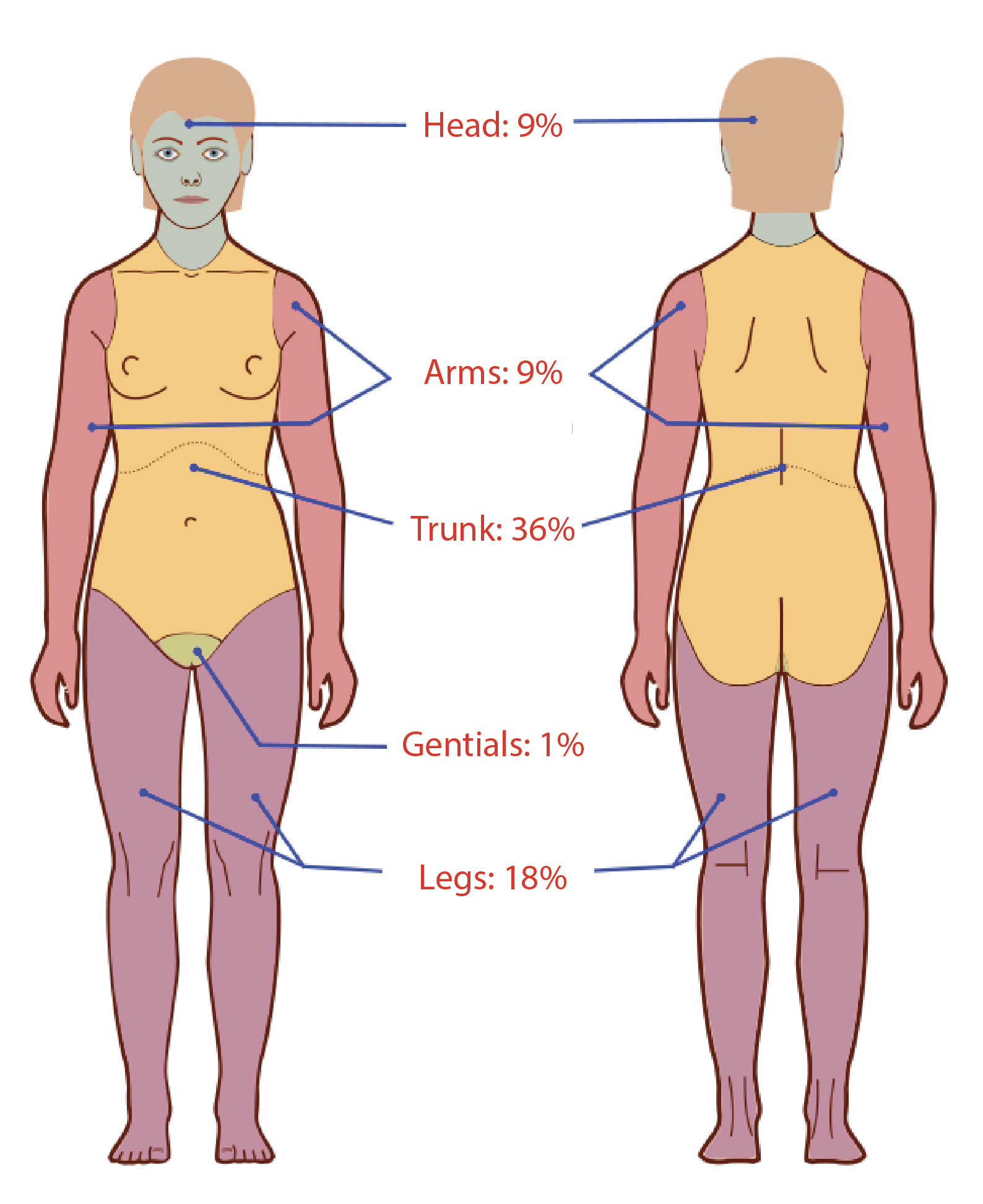 Diagram of rule of 9s for adults.