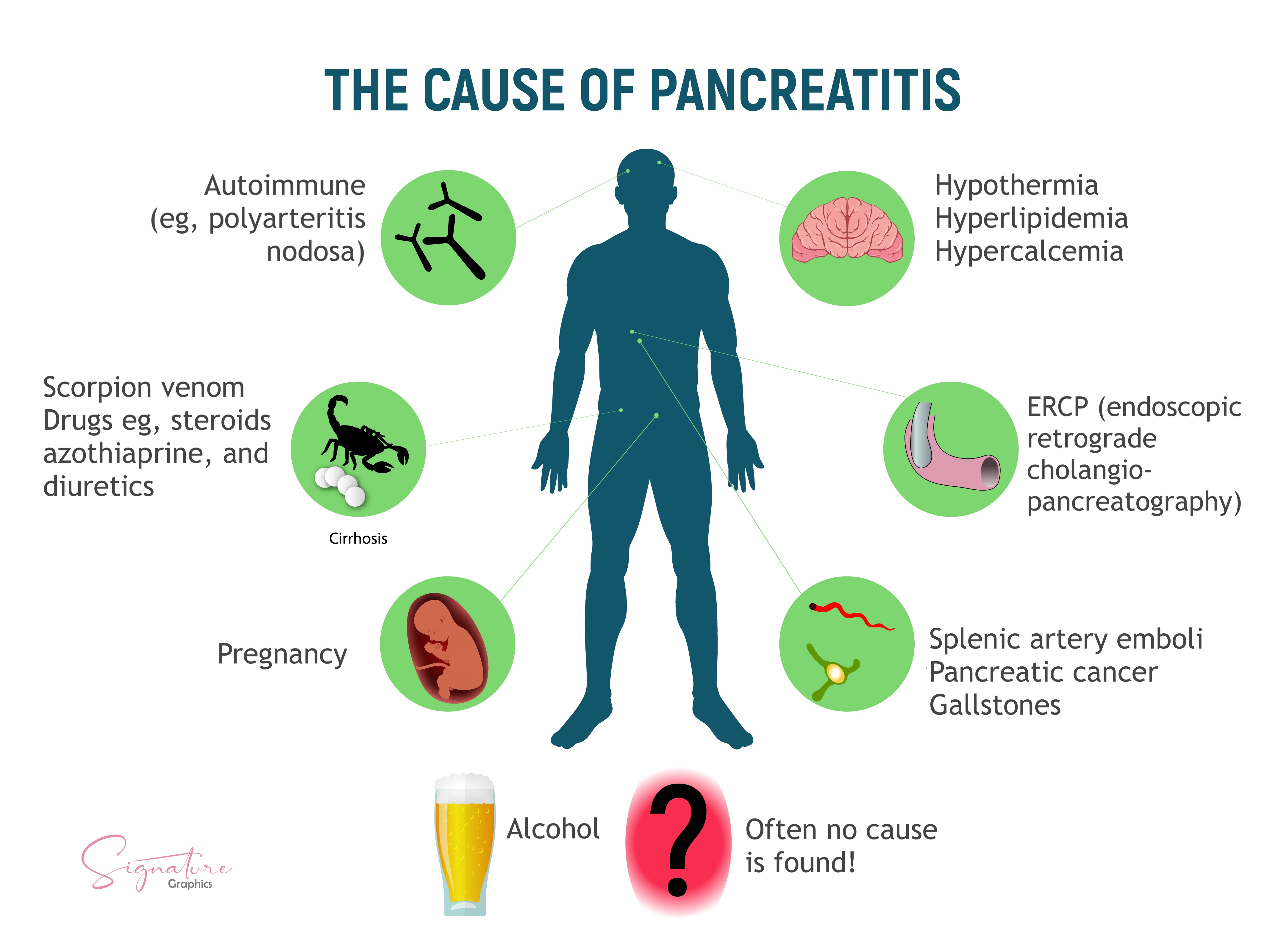 This is a graphic illustration of the causes of acute pancreatitis.