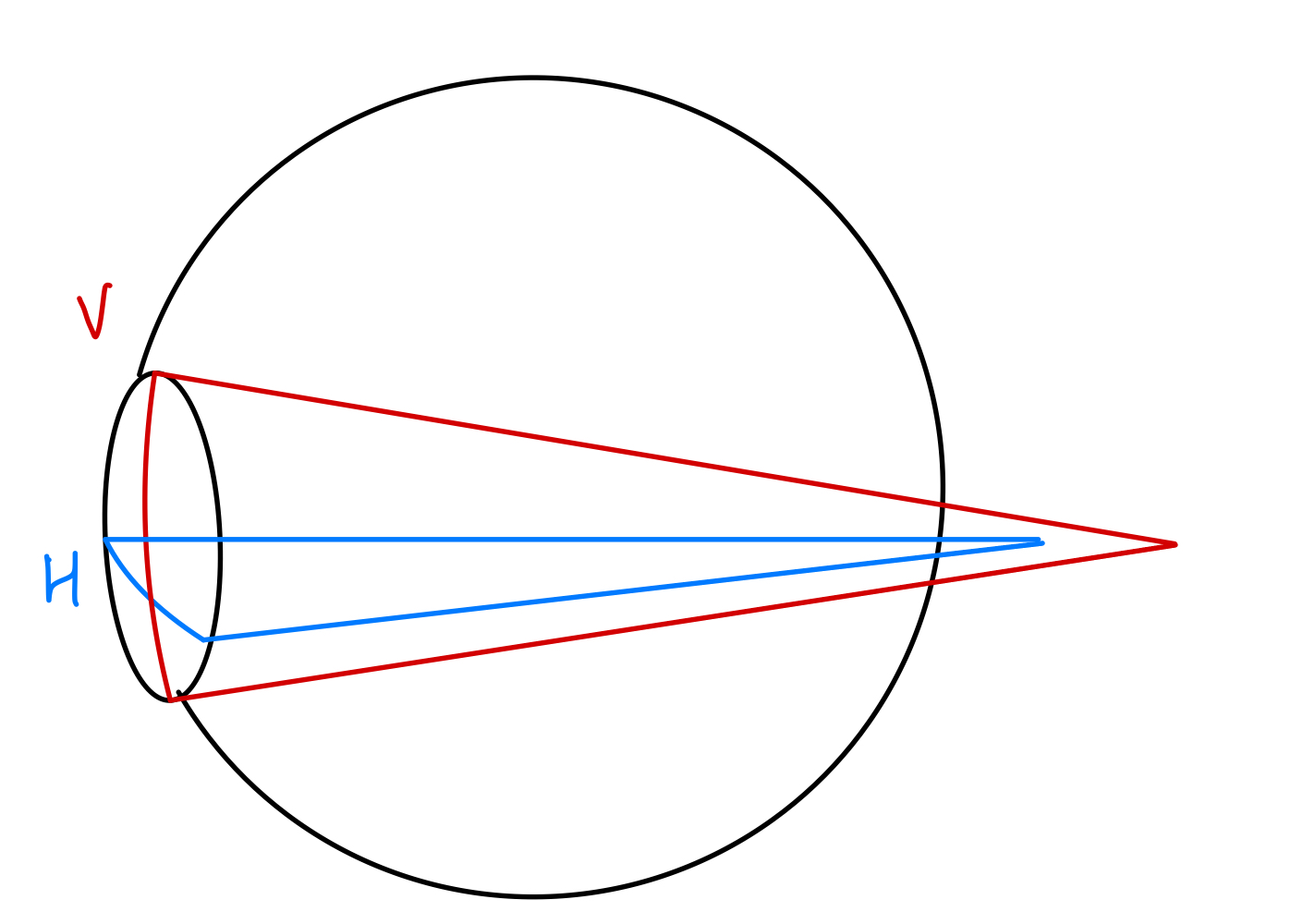 Compound hypermetropic astigmatism