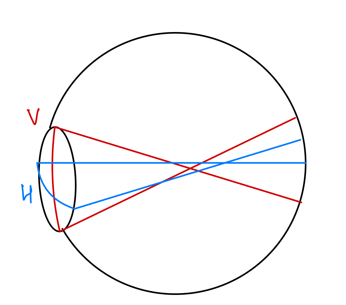 Compound myopic astigmatism