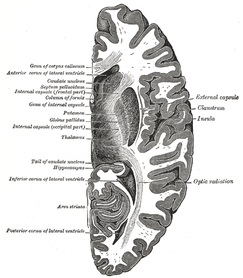 Horizontal section of right cerebral hemisphere, Genu of Corpus callosum, Anterior cornua of lateral ventricle, Caudate nucle