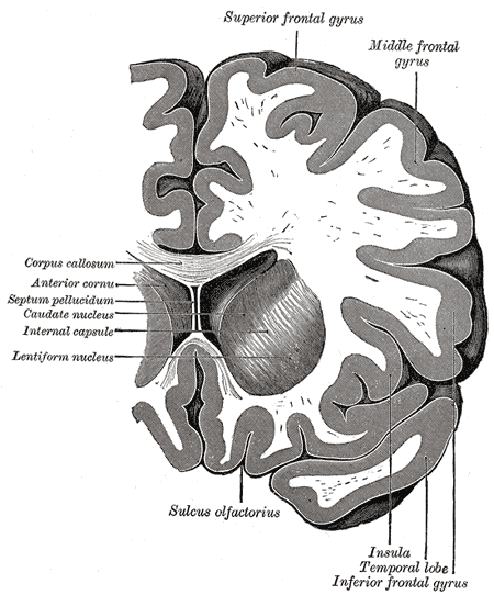 Coronal section through anterior cornua of lateral ventricles, Superior frontal gyrus, Middle Frontal Gyrus, Corpus callosum,