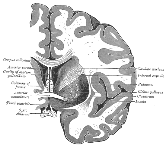 Coronal section of brain through anterior commissure, Caudate nucleus, Internal Capsule, Putamen, Globus pallidus, Claustrum,