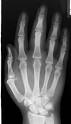 <p><a href="https://www.cnn.com">test</a>PA Hand X-ray</p>