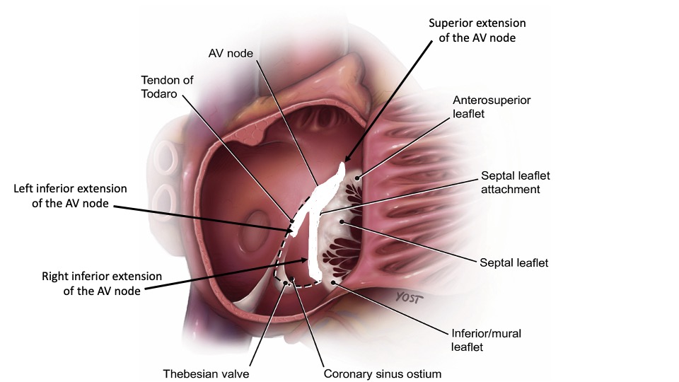 Triangle of Koch.  Triangle of Koch with the compact atrioventricular (AV) node and its inferior and superior extensions.