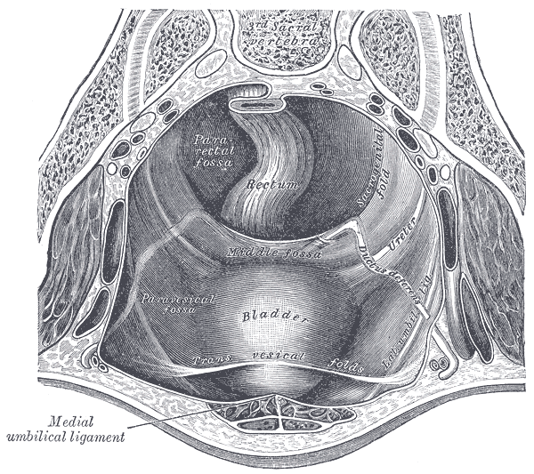 The Abdomen, The peritoneum of the male pelvis, Medial umbilical ligament, Rectum, Bladder, Pararectal fossa, Paravesical fos