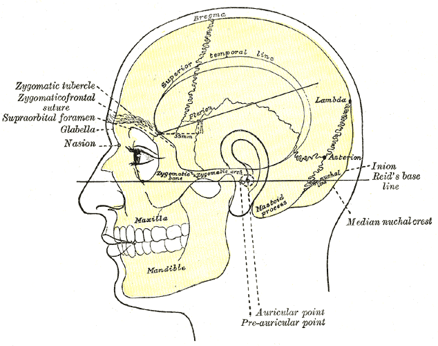 Surface Anatomy Surface Markings,  Side view of head; showing surface relations of bones, Zygomatic Tubercle, Zygomaticofront