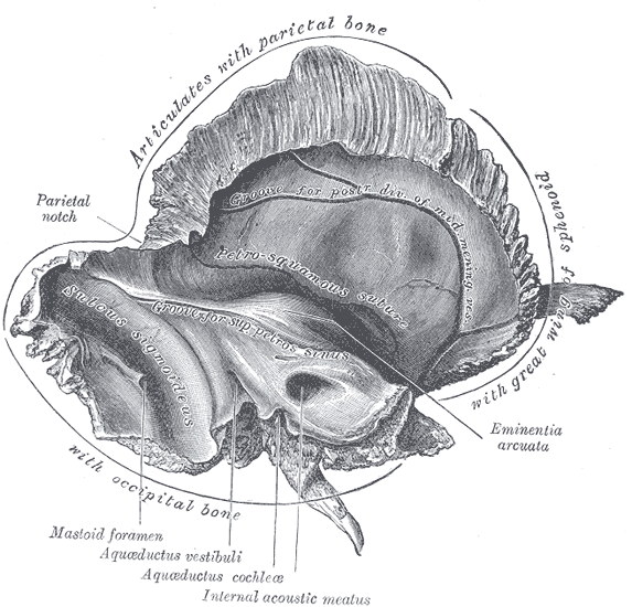 The  Left temporal bone; Inner surface