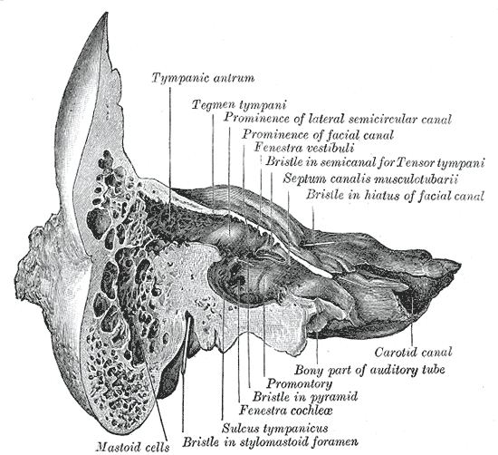 The Temporal Bone, Coronal section of right temporal bone