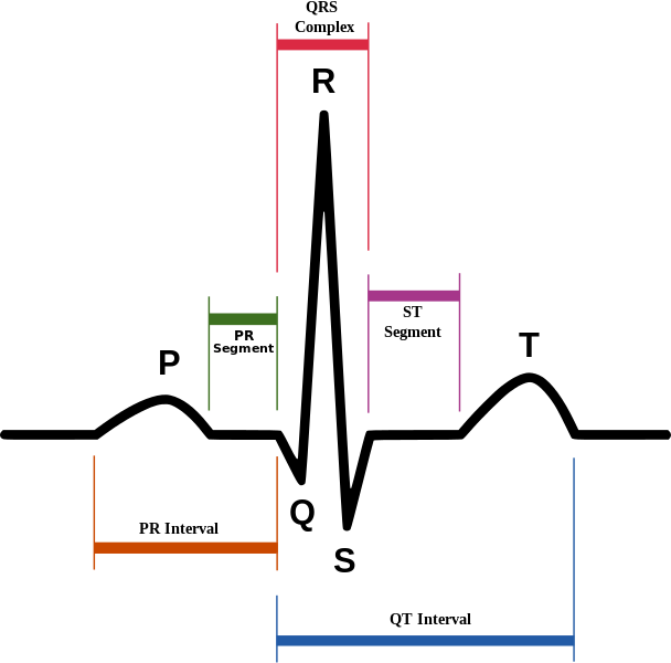 Schematic diagram of normal sinus rhythm for a human heart as seen on ECG