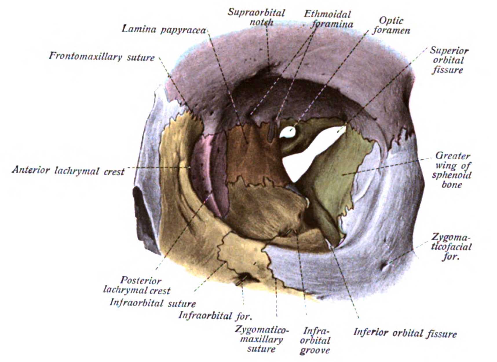 Orbit as seen from the front, with bones labeled in different colors, and superior orbital fissure at center as an "hour-glass" formation