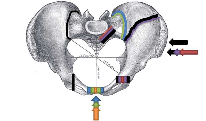 <p>Pelvic Fracture Types