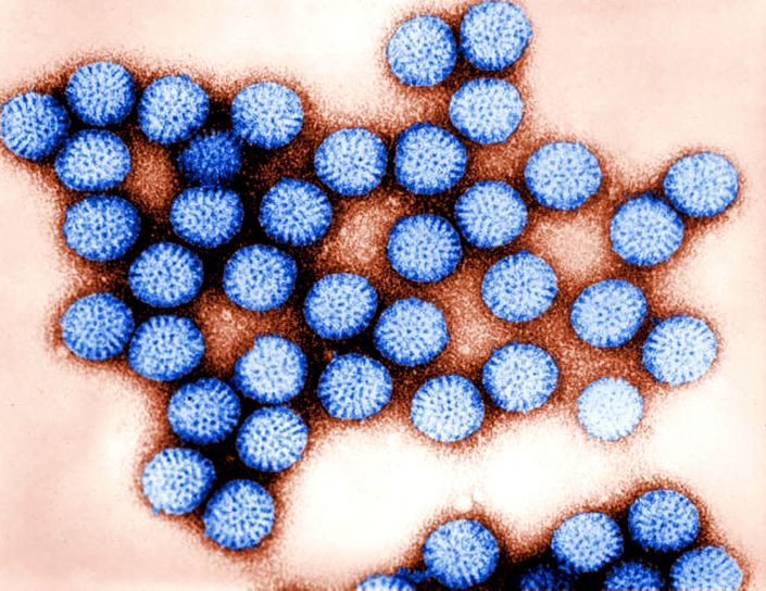 Ultrastructural, morphology, number, intact, rotavirus, double, shelled, particles