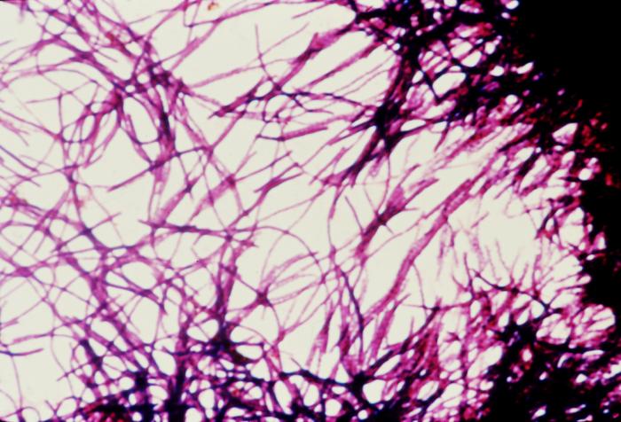 Pathology, Impression smear photomicrograph, Clostridium difficile bacteria, Cycloserine mannitol blood agar