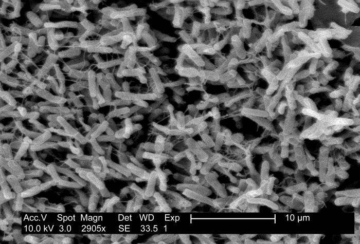 Pathology, Micrograph, Gram-positive, Clostridium difficile, colitis