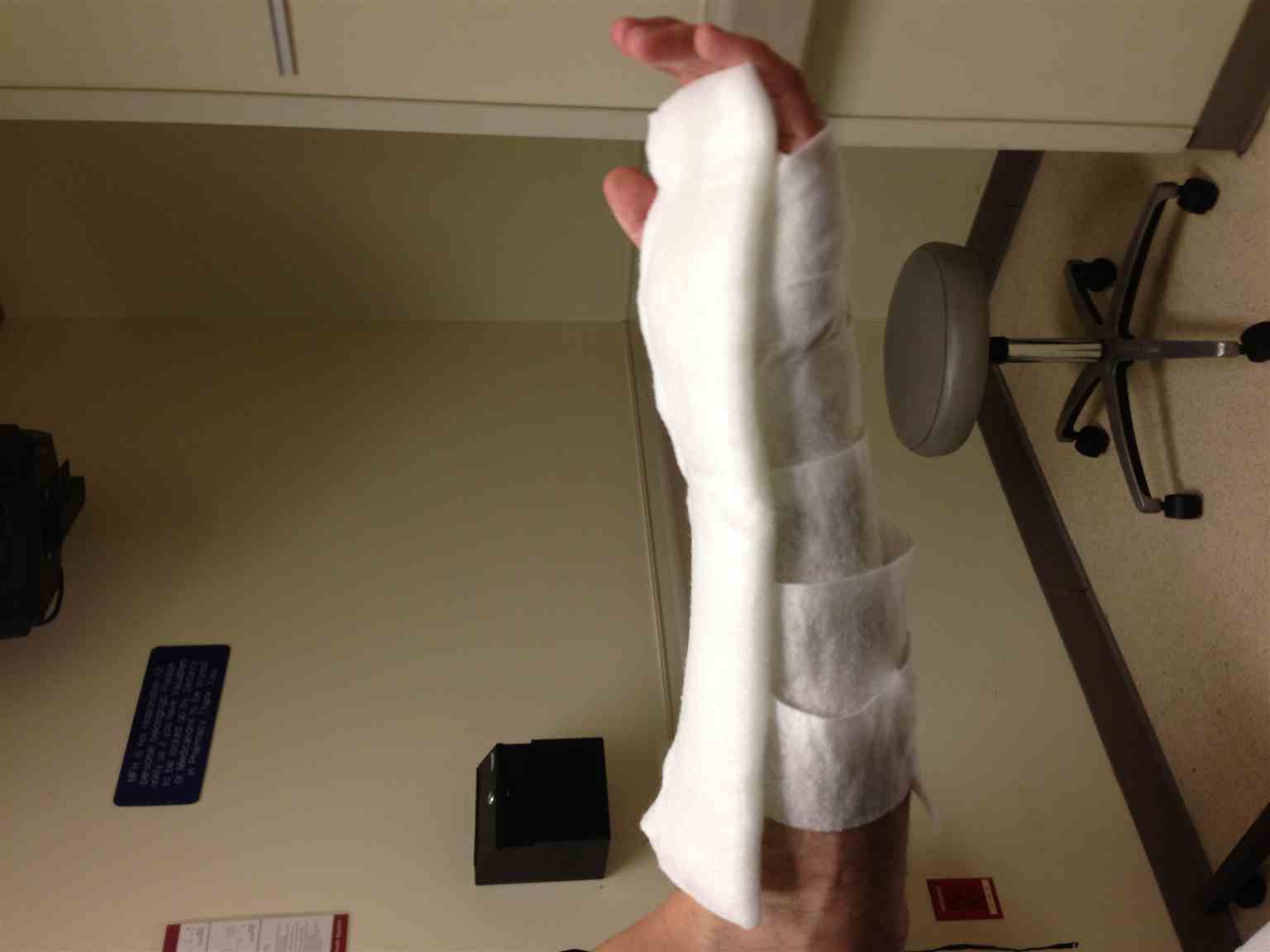 Volar Splint Side View