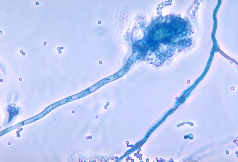 Aspergillus fumigatus