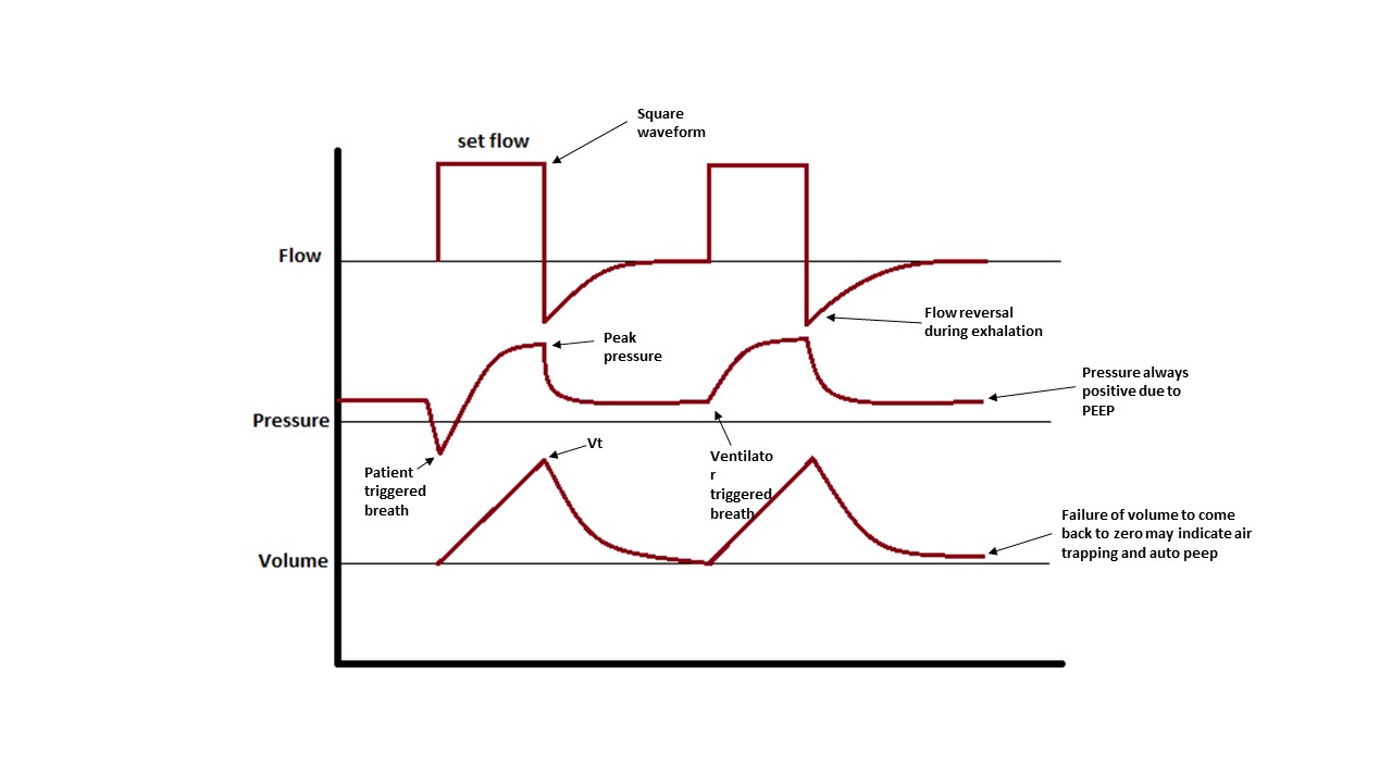 Assist control (AC) ventilation