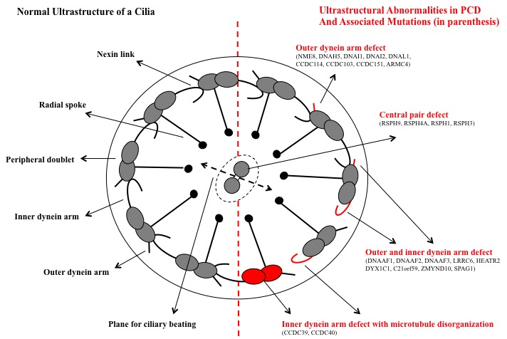 Ciliary Dyskinesia, Normal Ultrastructure of a Cilia, Ultrastructure Abnormalities in PCD and Associated Mutations