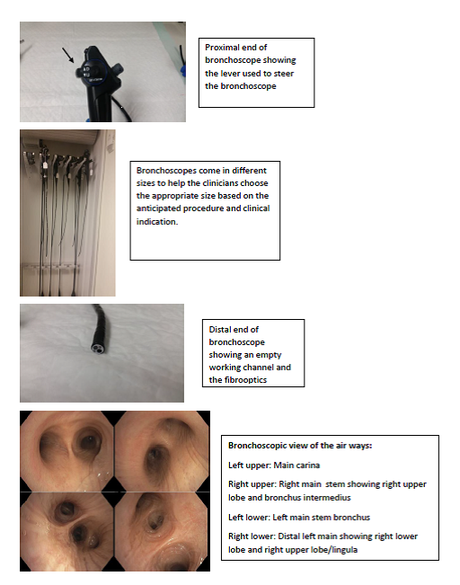 Bronchoscopy parts and bronchoscopic view of the airways