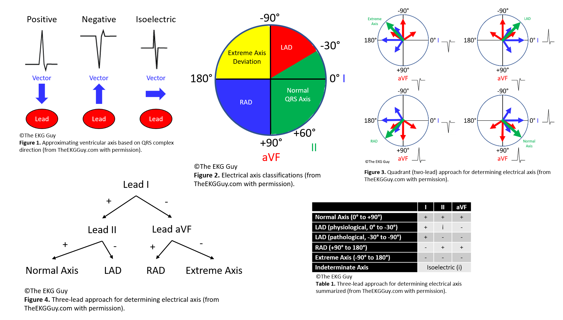 Electrical Axis (from TheEKGGuy.com with permission)